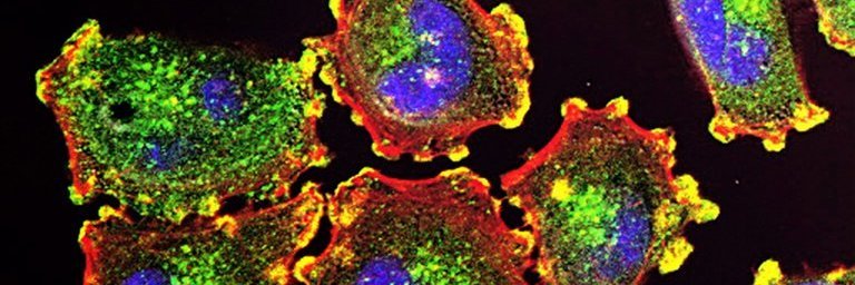 Image: Laboratory image cancer cells